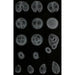 Development of an Infuser - Alfred Frödl — artwork view