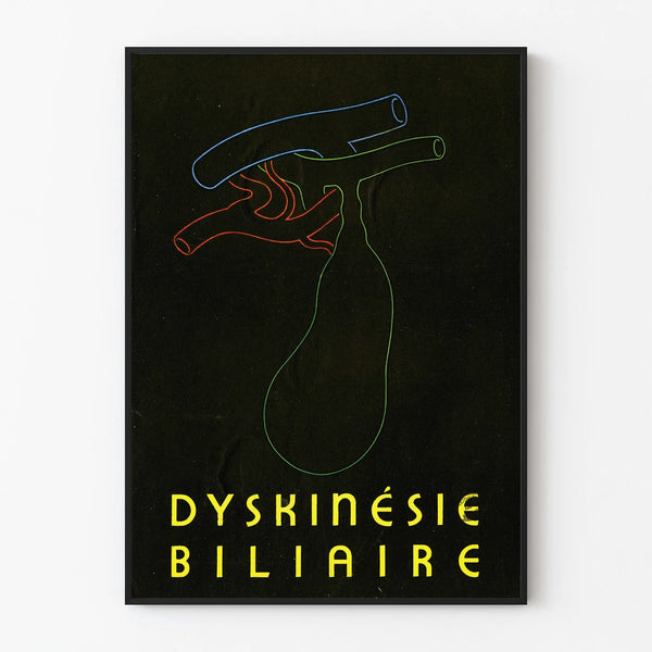 Minimalist Medical Poster of Biliary Dyskinesia