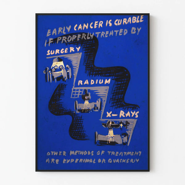 Vintage Poster on Early Cancer Treatment by Surgery and Radiotherapy