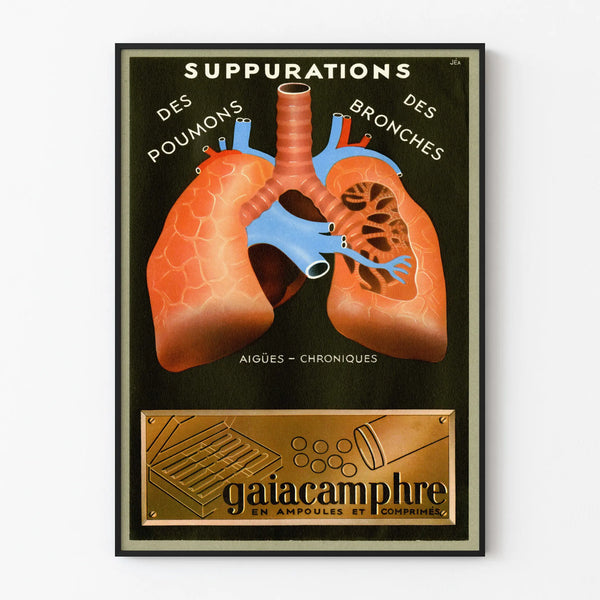Vintage medical poster of lungs and bronchi - Health wall decoration