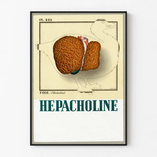 Vintage Medical Poster Hepatic Liver Illustration