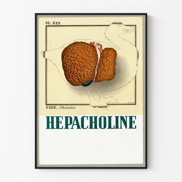 Vintage Medical Poster Hepatic Liver Illustration