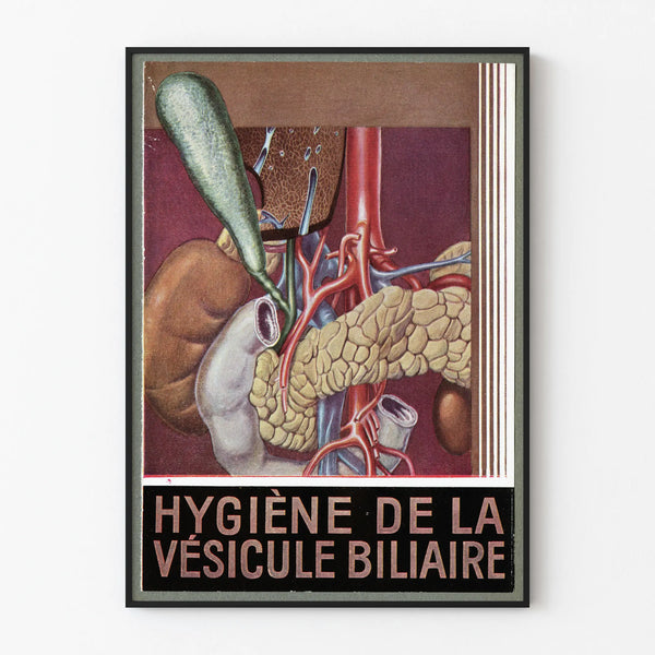 Vintage Poster of Biliary Vesicle Hygiene - Medical Wall Decoration