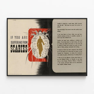 Vintage educational poster on scabies and its prevention — framed artwork on a wall