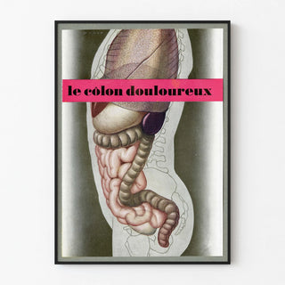 Vintage Medical Anatomy Poster – The Painful Colon