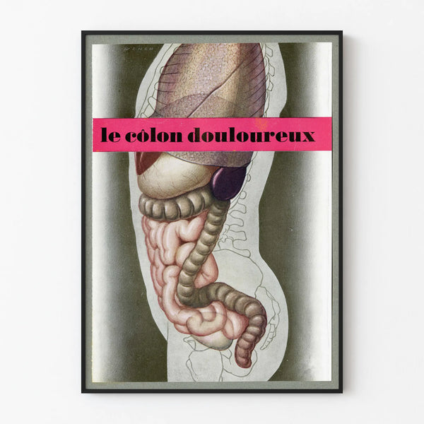 Vintage Medical Anatomy Poster – The Painful Colon
