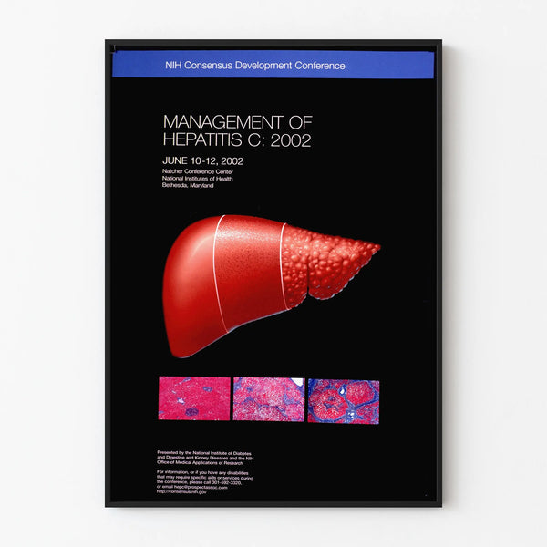 Vintage medical poster on hepatitis C management 2002