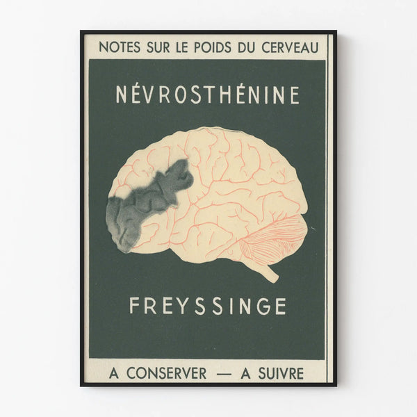 Vintage Scientific Poster on Cerebral Neurosurgery