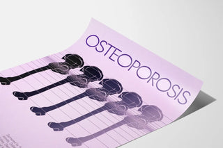 Poster Bone Gradient Osteoporosis Vintage 1984