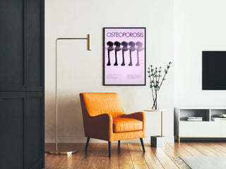 Poster Bone Gradient Osteoporosis Vintage 1984