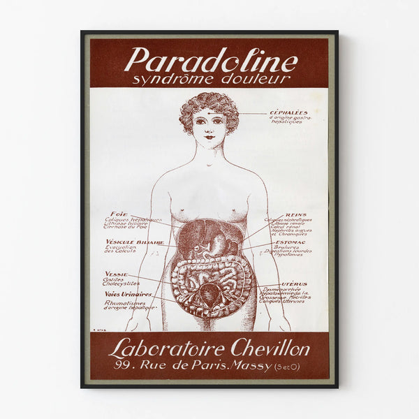 Vintage medical poster Paradoline - Decorative diagram of abdominal pain