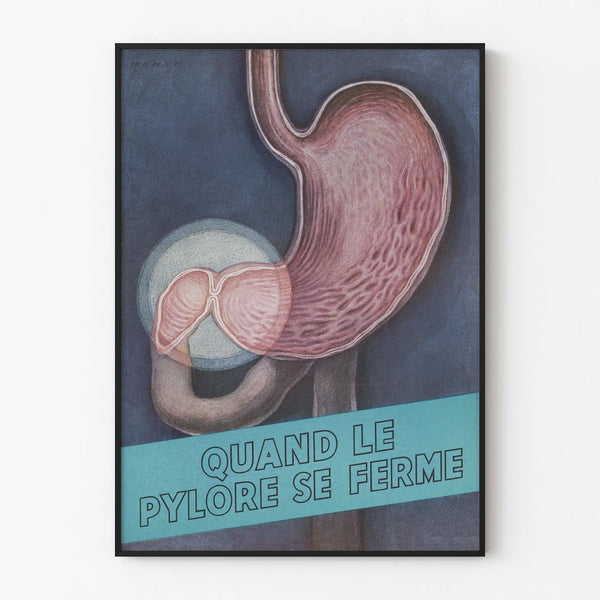 Anatomical Poster of the Pylorus and Stomach - Medical Wall Decoration