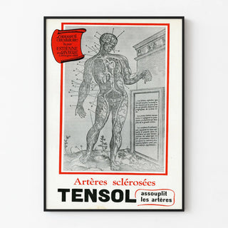 Vintage medical poster of the scleral arteries TENSOL