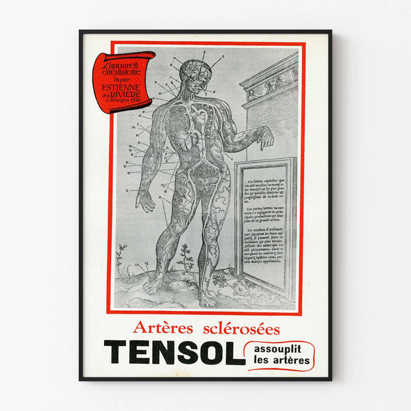 Vintage medical poster of the scleral arteries TENSOL