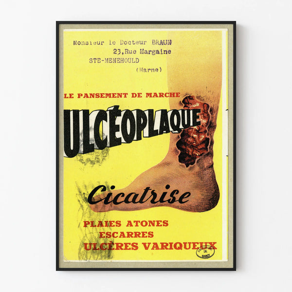 Vintage Ulcéoplaque Poster - Medical Wall Poster