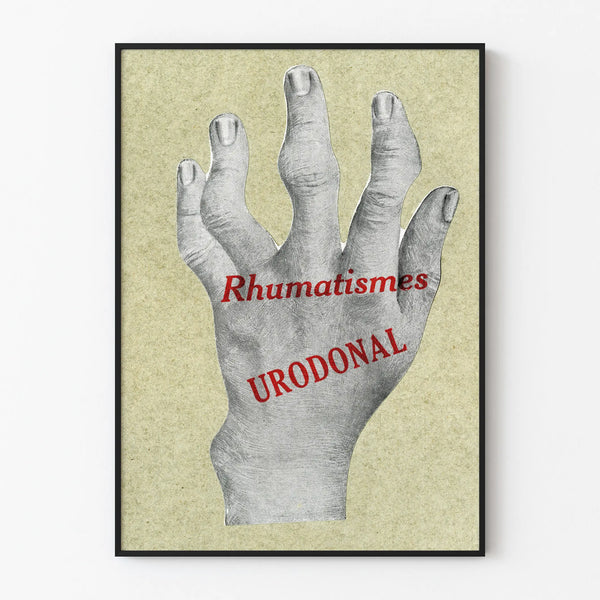 Vintage poster of a deformed hand for rheumatism - Urodonal